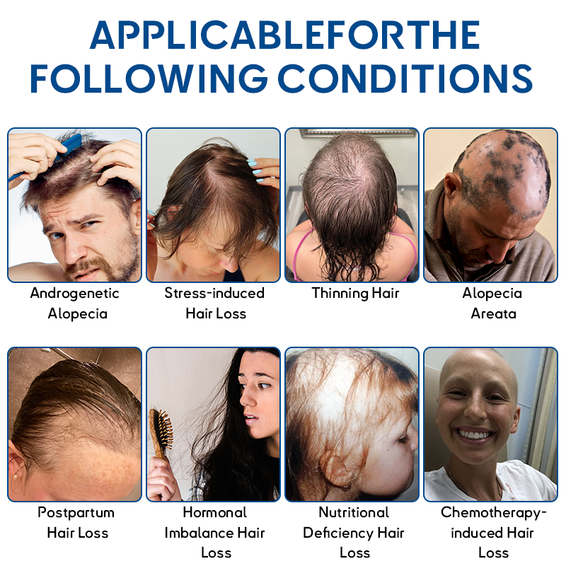🇺🇸FDA-Approved | Flysmus® STEM Cell Hair Cycle Roller - Instantly Stops Hair Loss and Promotes Real Regrowth (🔥Up to 80% OFF)