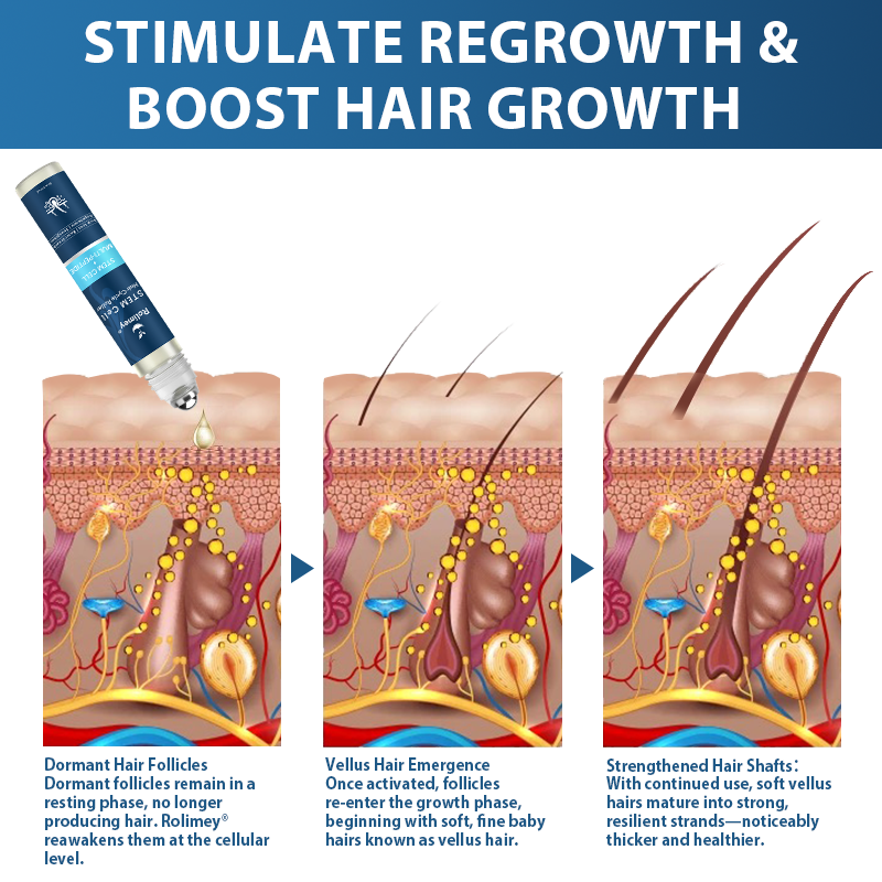 🇺🇸🍁Developed by Trichologists: 𝐑𝐨𝐥𝐢𝐦𝐞𝐲® 𝐒𝐓𝐄𝐌 𝐂𝐞𝐥𝐥 𝐇𝐚𝐢𝐫 𝐂𝐲𝐜𝐥𝐞 𝐑𝐨𝐥𝐥𝐞𝐫 – Instantly Stops Hair Loss & Promotes Real Regrowth (🔥Up to 80% OFF🔥)