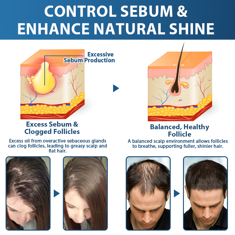 🇺🇸🍁Developed by Trichologists: 𝐑𝐨𝐥𝐢𝐦𝐞𝐲® 𝐒𝐓𝐄𝐌 𝐂𝐞𝐥𝐥 𝐇𝐚𝐢𝐫 𝐂𝐲𝐜𝐥𝐞 𝐑𝐨𝐥𝐥𝐞𝐫 – Instantly Stops Hair Loss & Promotes Real Regrowth (🔥Up to 80% OFF🔥)