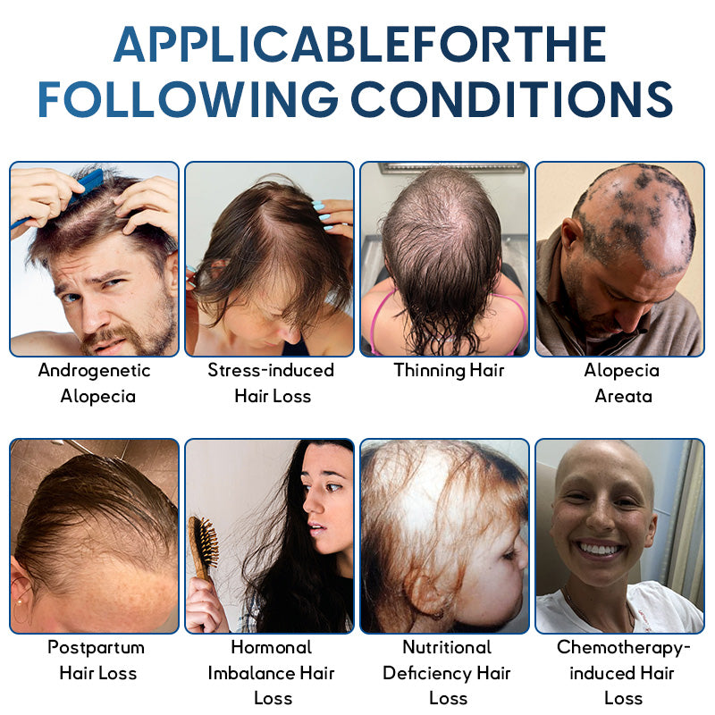 🇺🇸🍁Developed by Trichologists: 𝐑𝐨𝐥𝐢𝐦𝐞𝐲® 𝐒𝐓𝐄𝐌 𝐂𝐞𝐥𝐥 𝐇𝐚𝐢𝐫 𝐂𝐲𝐜𝐥𝐞 𝐑𝐨𝐥𝐥𝐞𝐫 – Instantly Stops Hair Loss & Promotes Real Regrowth (🔥Up to 80% OFF🔥)